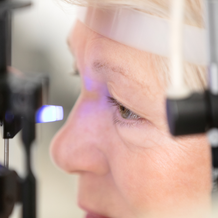 Terapia Farmacologica Glaucoma