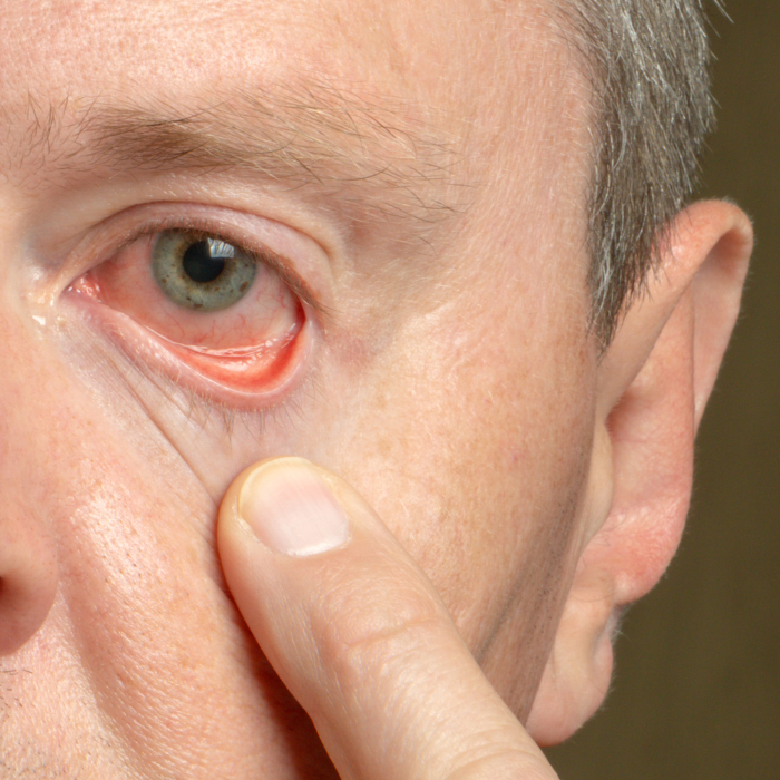 Monitoraggio & Follow-up Glaucoma